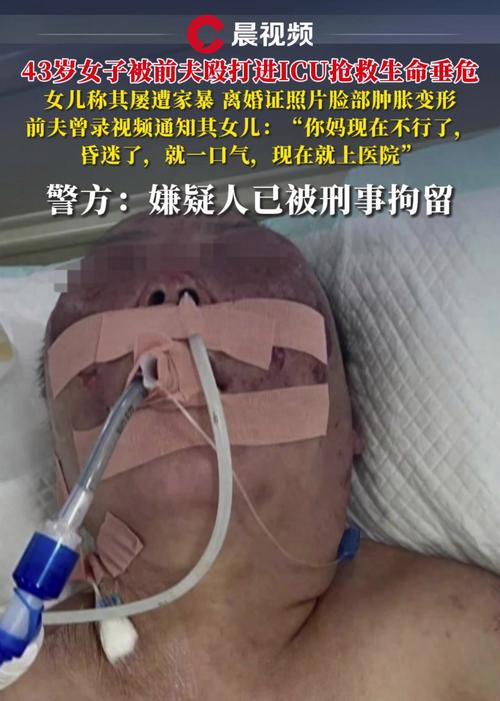 辽宁营口一女子遭前夫殴打住进ICU,经抢救无效不幸去世